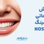 امیقا پیرسینگ تهران