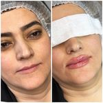 مرکز لیزر مرکز زیبایی دکتر مهسا رحیمی