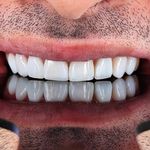 خدمات دندانپزشکی دکتر زهرا خلیلی