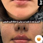 کلینیک زیبایی و جوانسازی پوست و مو الین