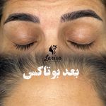 مجموعه زیبایی لاریسا - سمنان - 9663