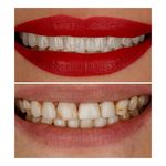 متخصص دندانپزشکی ترمیمی دکتر ساناز عباسی