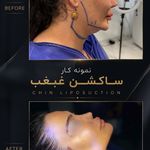 کلینیک تخصصی زیبایی و لیزر موی ابریشم