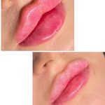 کلینیک پوست و مو و لیزر نیلوفر آبی