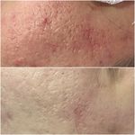 مرکز لیزر و پاکسازی پوست روژین