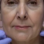 کلینیک زیبایی الماس کاملا اقساطی