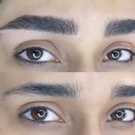 مرکز تخصصی فیبروز ابرو مژگان خناری