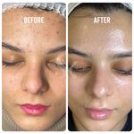 خدمات تخصصی فیشال سارا اسکین بار