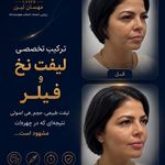 کلینیک لیزر و زیبایی مهسان