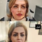 کلینیک پوست و مو زیبایی آلفا