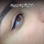 میکرو مهدیه