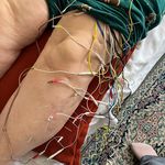 فیزیوتراپی به گام