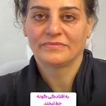 کلینیک زیبایی شایلی