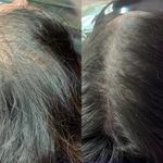 اسکالپ و میکرو اسکالپ سر خانم و آقا شادی