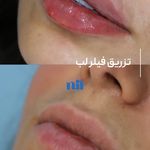 کلینیک زیبایی و لیزر نیل