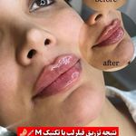 مرکز لیزر و کلینیک زیبایی پریفا