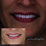 دندانپزشکی حامی (طرف قراردادبیمه نیستیم)