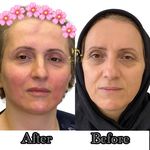 کلینیک پوست و زیبایی ولاغری تاج عظیمیه