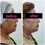 کلینیک زیبایی دکتر کاشانی