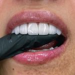 کلینیک‌دندانپزشکی دنتال آرنا-بیمه نیستیم