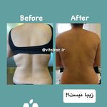 تغذیه و لاغری راز