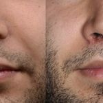 کلینیک زیبایی الماس کاملا اقساطی