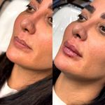 کلینیک تخصصی لیزر موهای زائد پریناز شرق