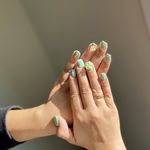 کاشت و ترمیم ستایش