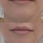 کلینیک لاغری، لیزر، پوست، مو لَوی