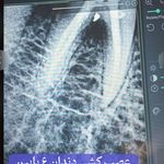 دکتر مسعود آقاخانی