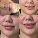 کلینیک زیبایی کاترین