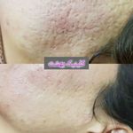 مرکز پوست و لیزر  سایناشور آمریکا دلدار