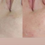 خدمات تخصصی پوست و مو مریم نصیرپور