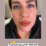 کلینیک زیبایی شایلی