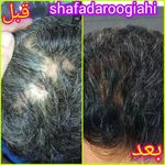 دارو گیاهی شفا طبیعی امجدی