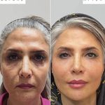 مرکز تخصصی تزریق فیلر و بوتاکس