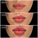 مطب  دکتر ملینا پورکاظمی