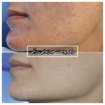 مرکز مژه و فیشیال متین