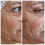 فیشال و پاکسازی پوست فلورا