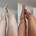 سولاریوم‌شاینی‌در دولت (ایستاده٫خوابیده)