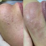 خدمات تخصصی پاکسازی پوست سحر