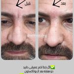 کلینیک لیزر و زیبایی مهرُنا