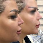 مطب  دکتر ملینا پورکاظمی
