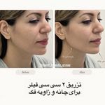 مرکز لیزر ،پوست و زیبایی کندی بیوتی