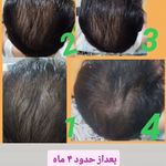 فروش محصولات گیاهی و درمانی نیوشا