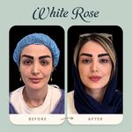 مرکز بلفاروپلاستی فوق تخصصی رز سفید