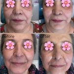 مرکز لیزر و کلینیک زیبایی پریفا