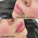 مطب پوست مو زیبایی و لاغری ژن شیک