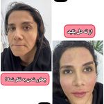 کلینیک پوست وزیبایی ومرکز تخصصی فیلربادی