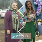 متخصص لاغری دکتر محمد یرانی(بیمه تکمیلی)